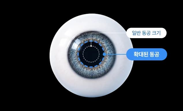 동공 확대