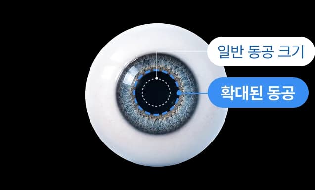 동공 확대